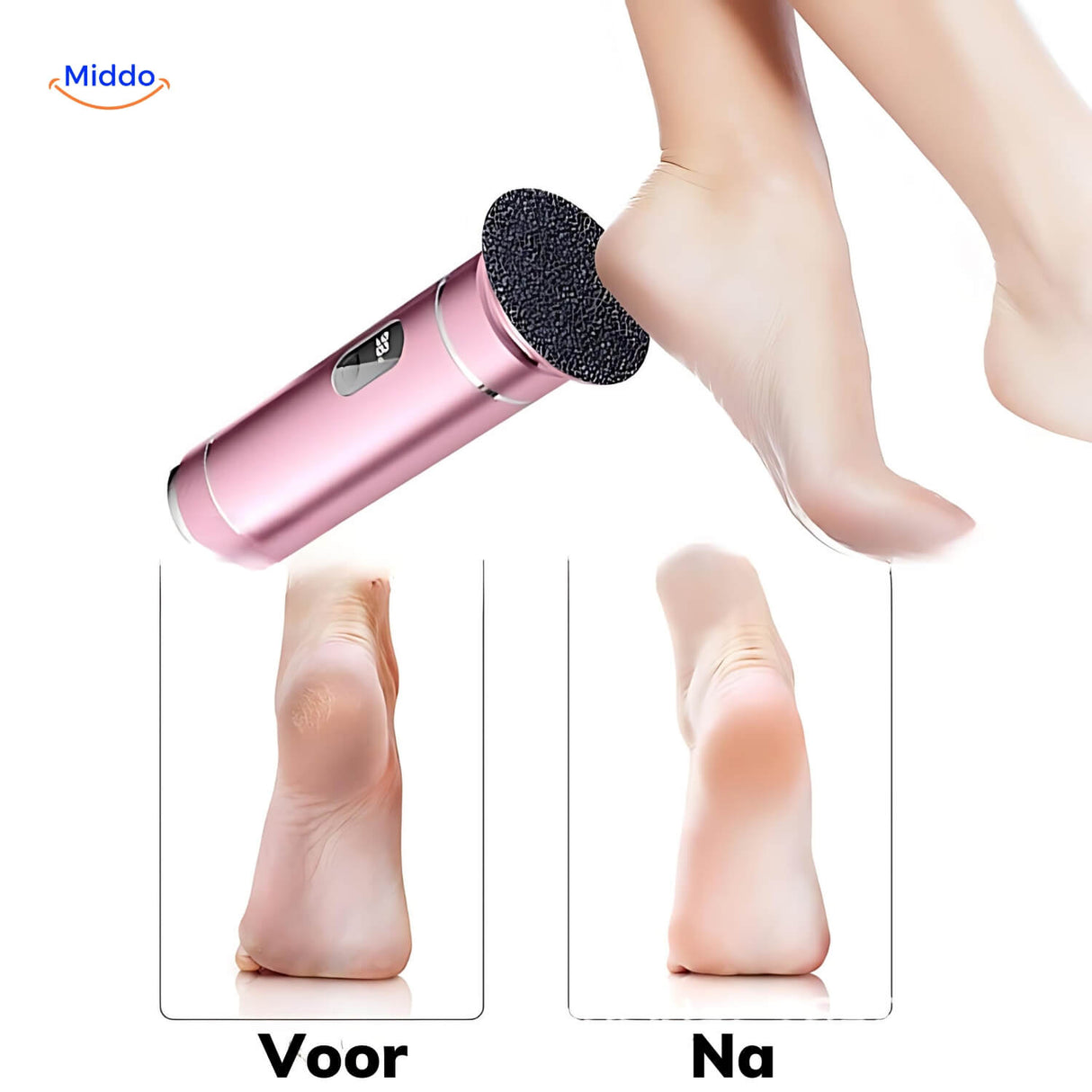 Before and after comparison showing smooth, soft feet results.