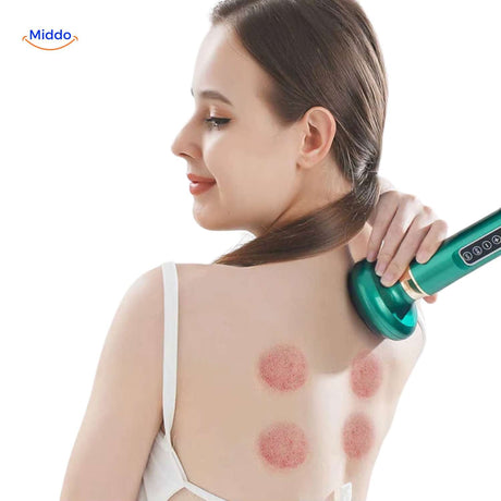 Electric cupping massage device delivering deep-tissue release and therapeutic circulation.