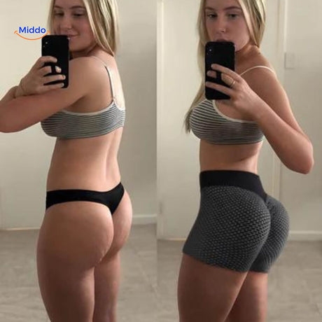 Cellulite reduction and skin smoothing effects demonstrated by ion fiber shaping shorts.